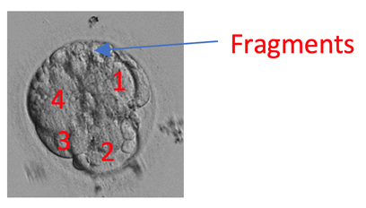blastocyst